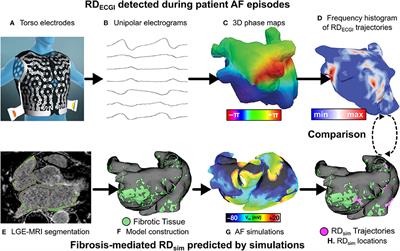 Comparing Reentrant Drivers Predicted by Image-Based Computational Modeling and Mapped by Electrocardiographic Imaging in Persistent Atrial Fibrillation